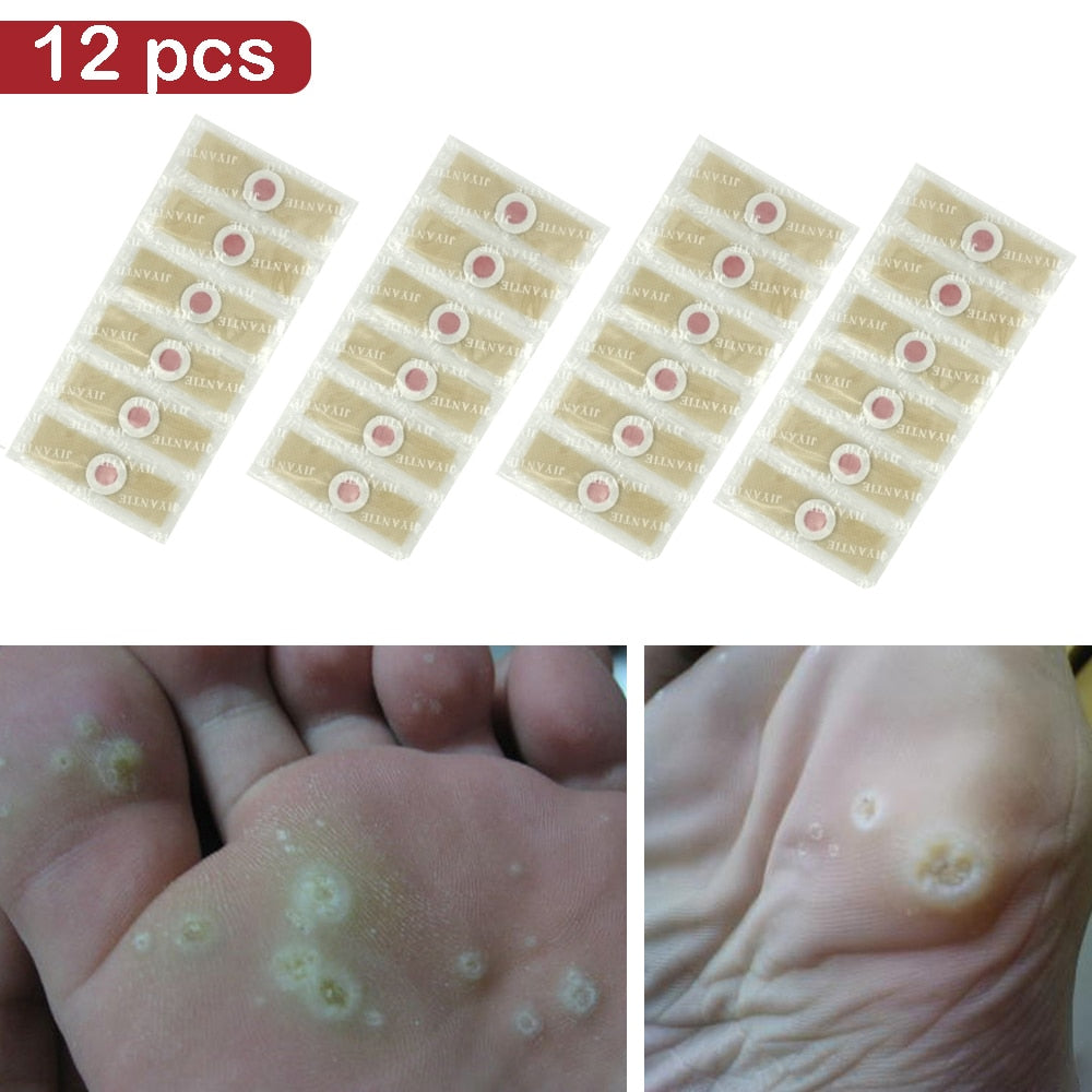 12pcs Medical Plasters Foot Corn Removal Warts Thorn patch  Corn of feet Calluses Callosity Detox clavus  Medical Patch