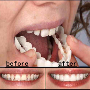 Hot Whitening Snap Perfect Smile Teeth Fake Tooth Cover On Smile Instant Teeth Cosmetic Denture Care for Upper One Size Fits